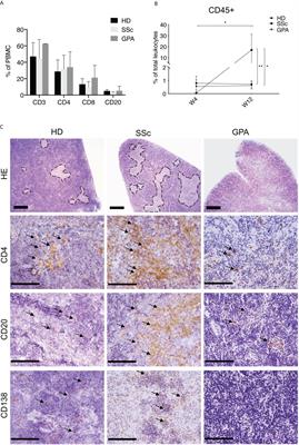 Transfer of PBMC From SSc Patients Induces Autoantibodies and Systemic Inflammation in Rag2-/-/IL2rg-/- Mice